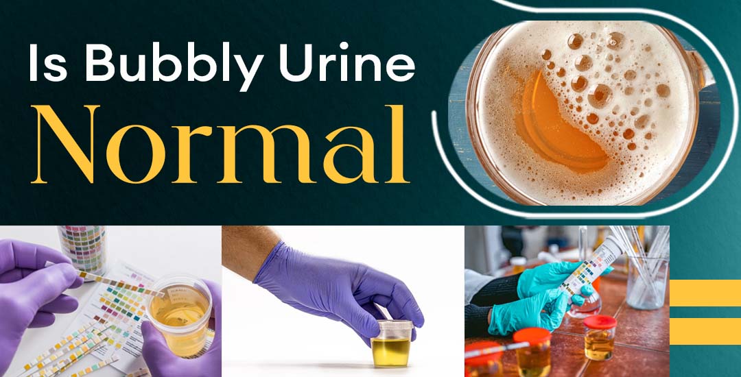 Is Bubbly Urine Normal? Causes, Symptoms & When to Worry